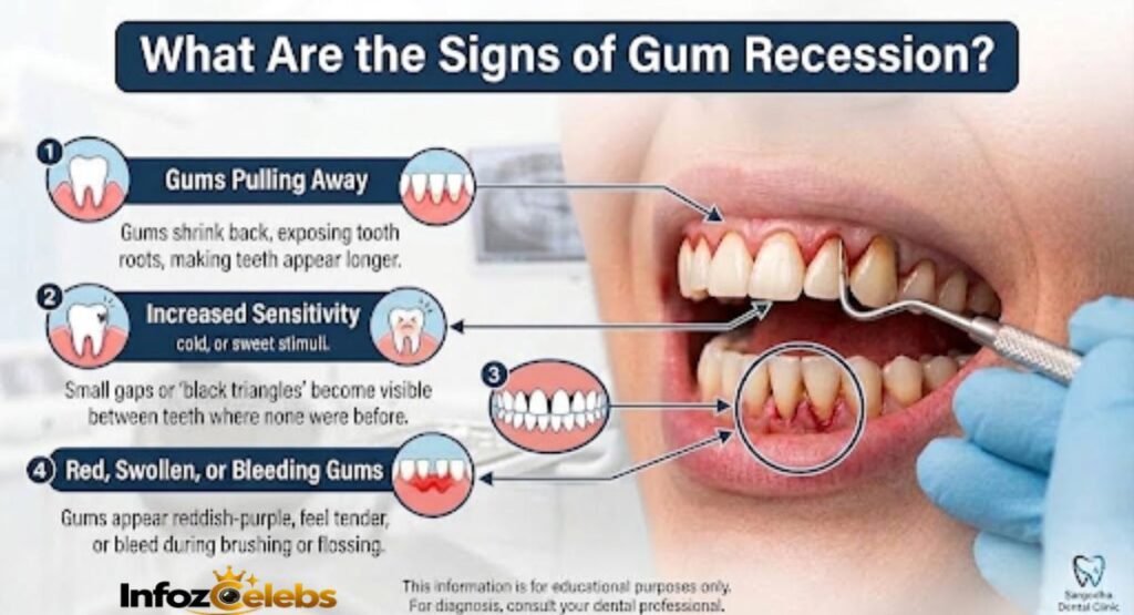 What Are the Signs of Gum